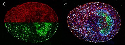 Gehirnorganoid aus humanen iPS-Zellen, tatschliche Gre ca. 0,5 cm, 
Immunfluoreszenzanalyse, rot = neuronale Zelle, blau = Zellkern, grn = sich 
teilende Zellen,  Matthias Jung/MLU